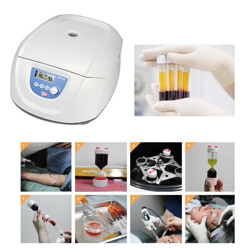 Bestseller Medizinische Blut-P – Medical Lab Center Bewertung und Preis